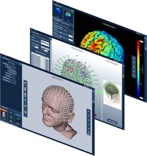 Brain simulation software